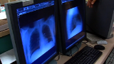 Curbing the rising cost of health care